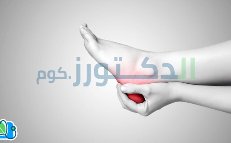 أسباب وعلاج شوكة القدم