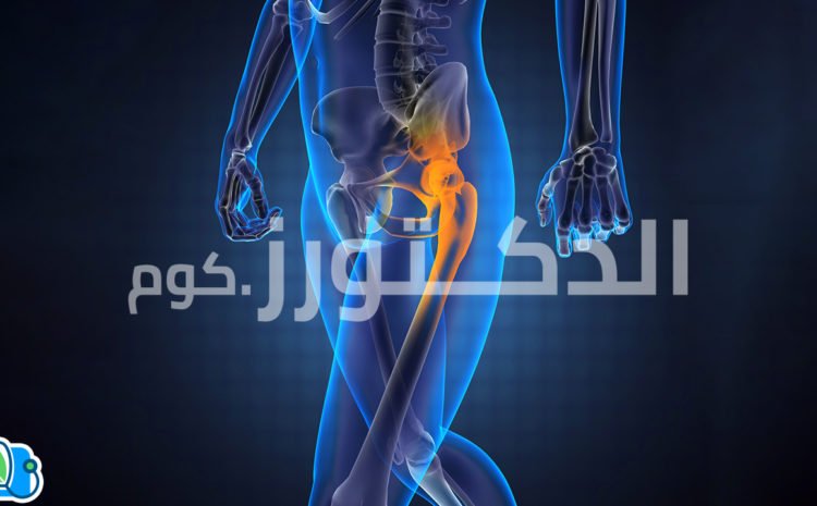 كل-ما-تريد-معرفته-عن-عمليات-تغيير-مفصل-الحوض