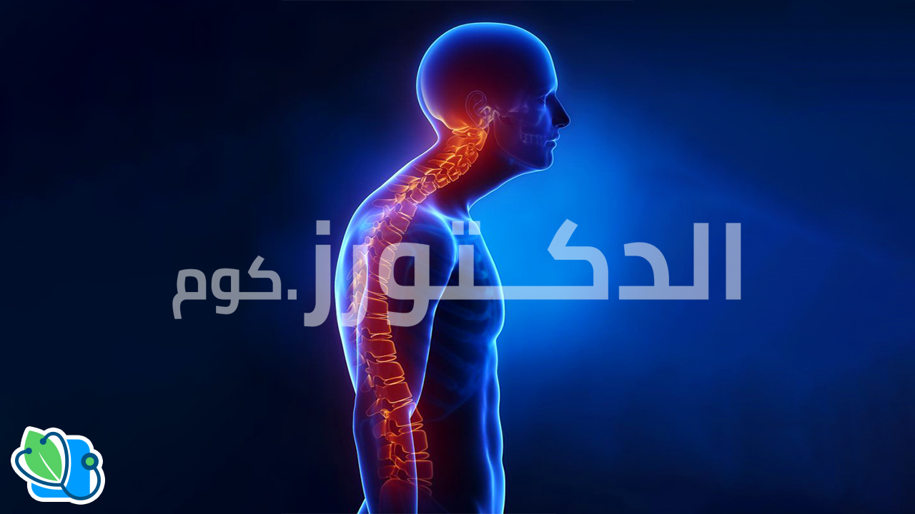 أسباب-و-علاج-تحدب-الظهر