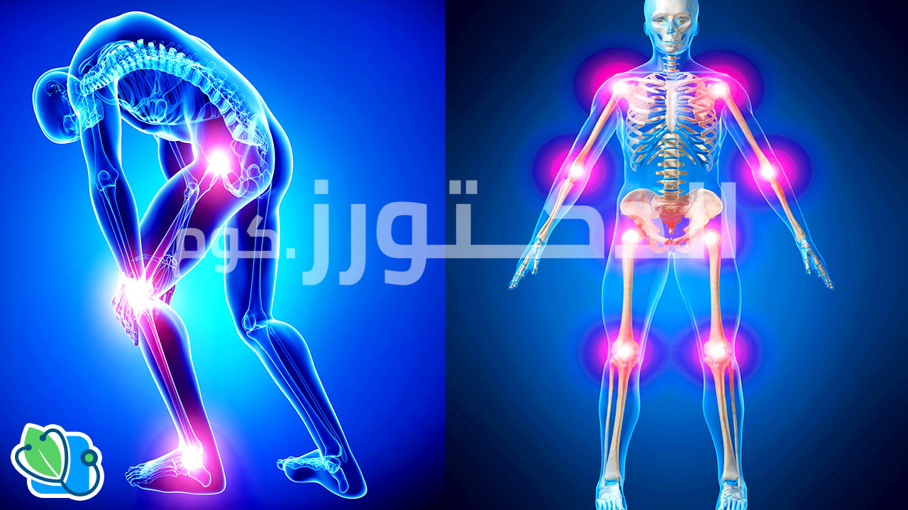 كيف تقضي على التهابات المفاصل