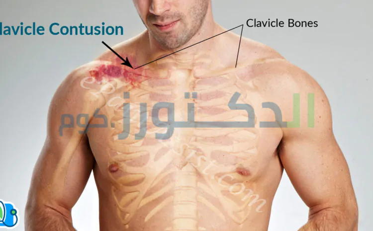خطورة-كسور-عظم-الترقوة-و-كيفية-علاجها-في-أسرع-وقت